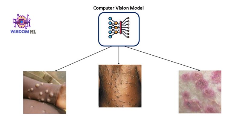 Monkeypox detection using computer vision approach